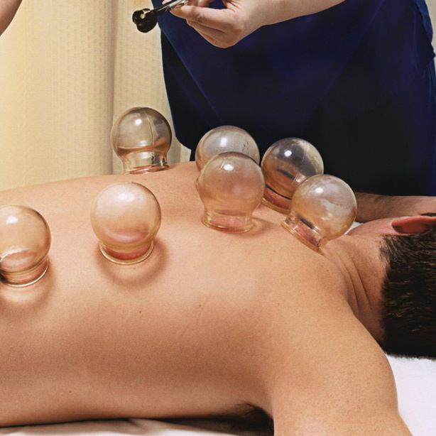 cupping massage therapy at bahria town Islamabad